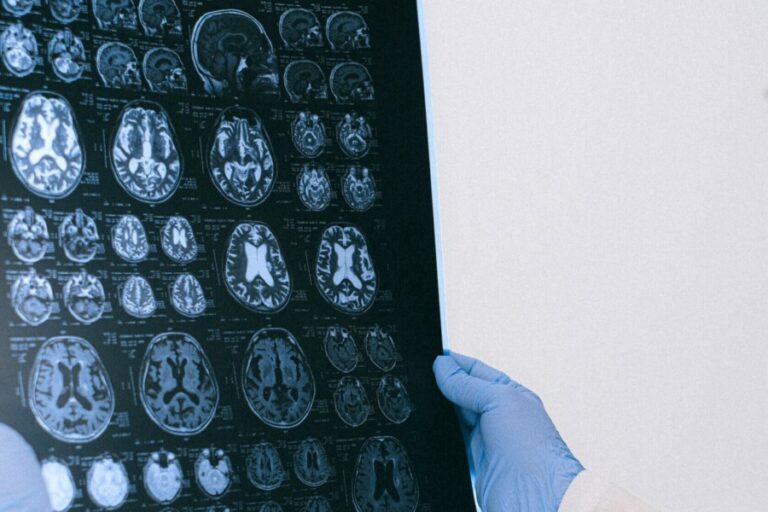 Röntgenbild für Vaskuläre Demenz